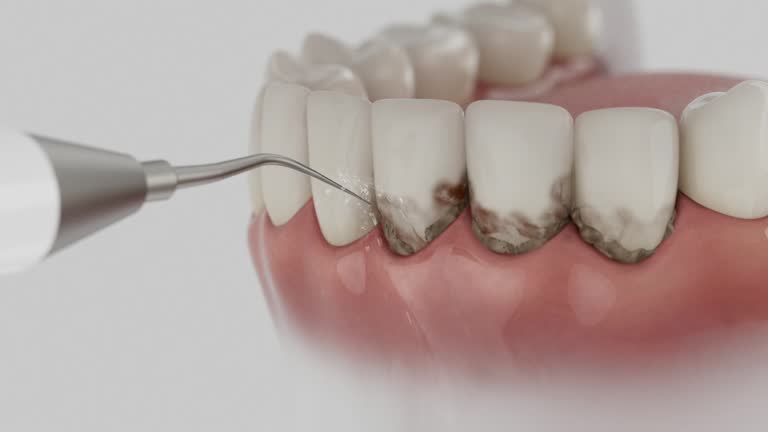 Trusted Invisalign Clear Aligners service in Levelland, TX - Dentist Open Now